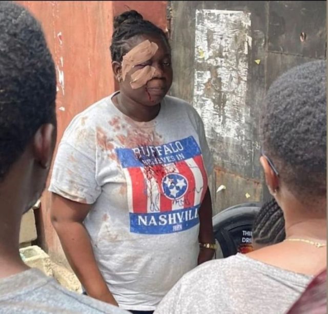 Brutalised by political thugs in Lagos but defied them to vote