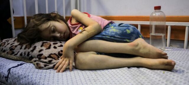 A child suffering from malnutrition lies on a bed in the Patient Society Hospital in Gaza City