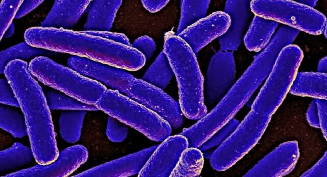 Ecoli