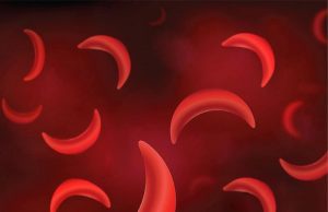 African Health Ministers launch drive to curb Sickle Cell Disease toll