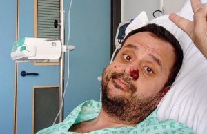 Monkeypox concern heightened after becoming a ‘Northern’ disease, says WHO