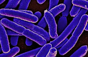 WHO warns of widespread resistance to common antibiotics worldwide